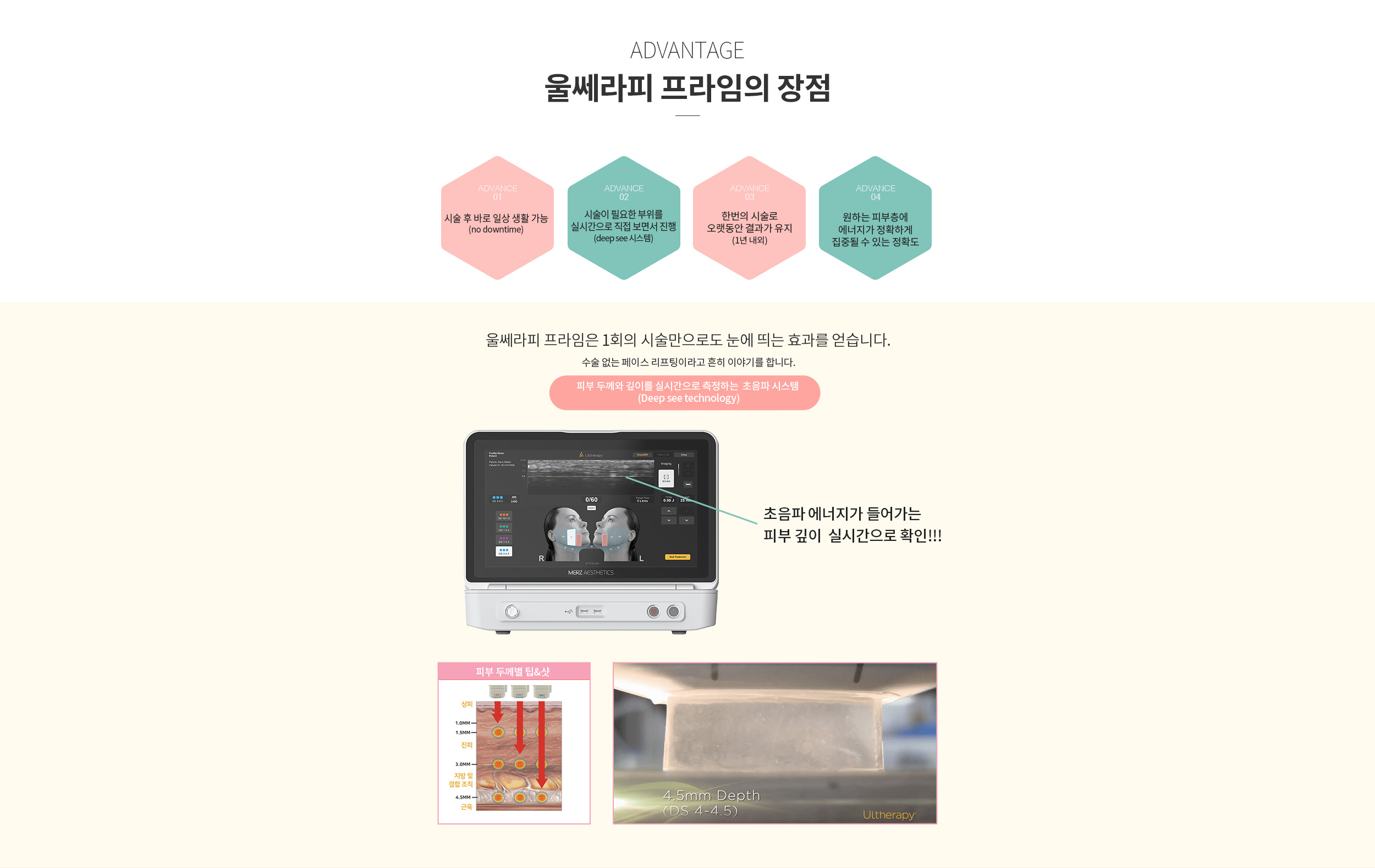 울쎄라피 프라임 장점