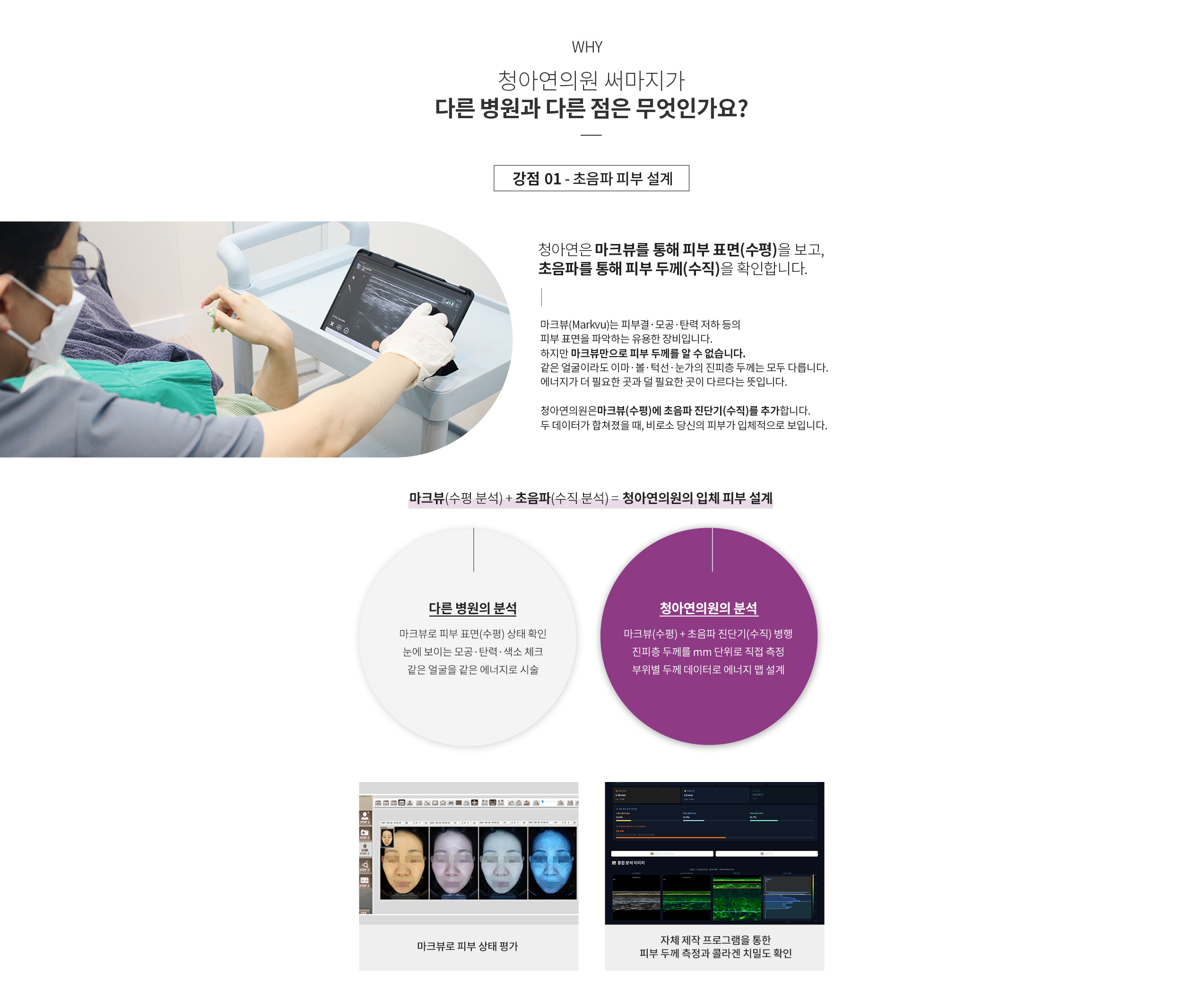 청아연 써마지의 다른 강점 : 초음파 진단을 통한 피부설계