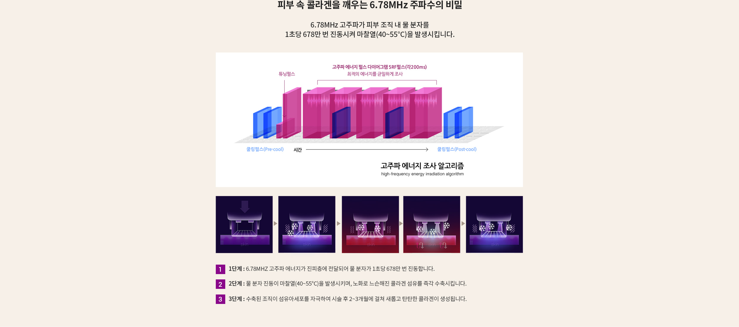 피부 속 콜라겐을 깨우는 6.78MHz 주파수의 비말