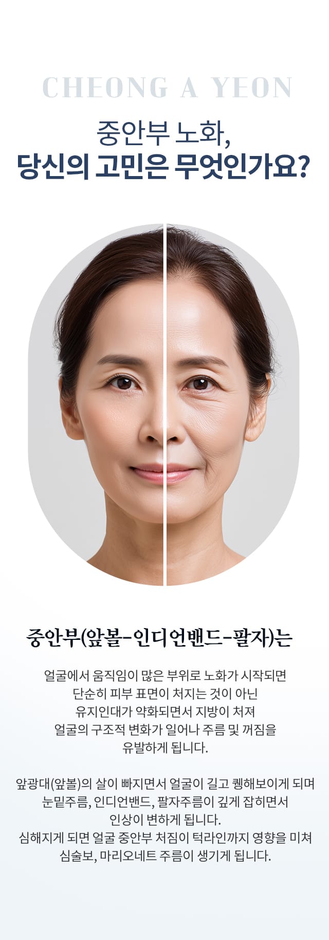 중안부 노화, 당신의 고민은 무엇인가요?